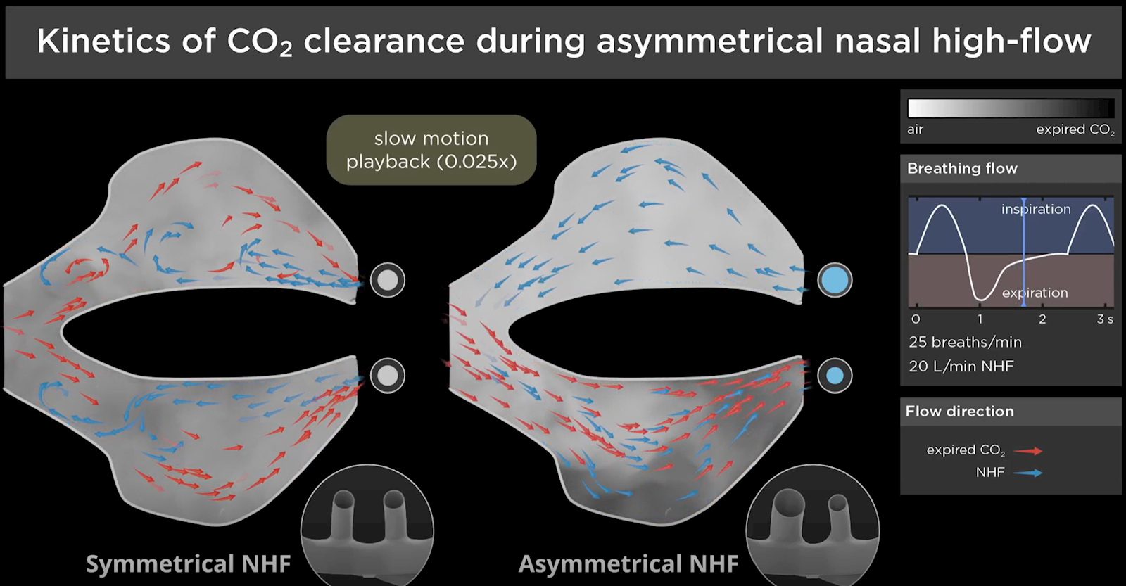 Asymmetric High Flow